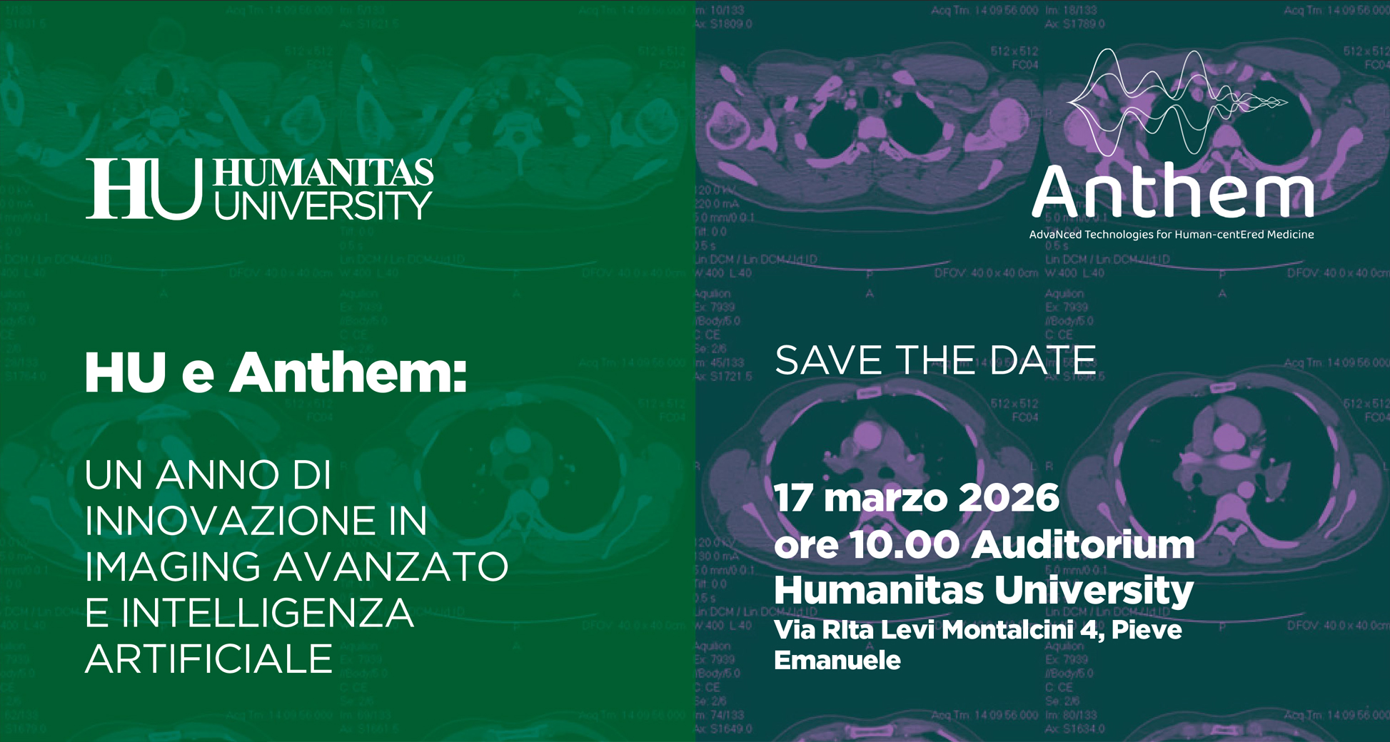Imaging avanzato e intelligenza artificiale in medicina: un anno di ricerca ANTHEM- Humanitas University